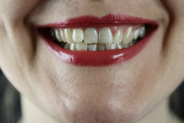 Healthy teeth and gums: A way to stay younger longer